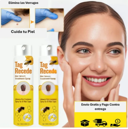 Despídete De Verrugas y Lunares Con TAG Recede