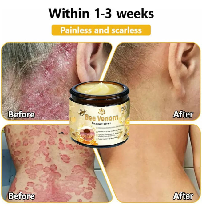 Revitaliza Tu Piel Con Crema de Abeja